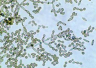 Microbiológicas