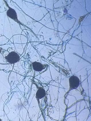 Microbiológicas